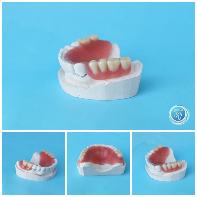 Realizăm proteze dentare